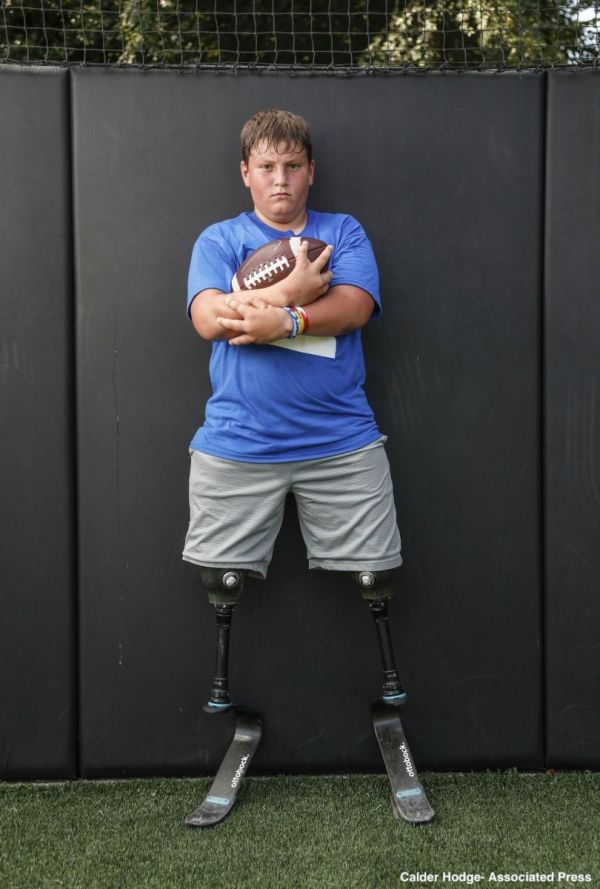 14-year-old Pursues Football With Two Prosthetic Legs